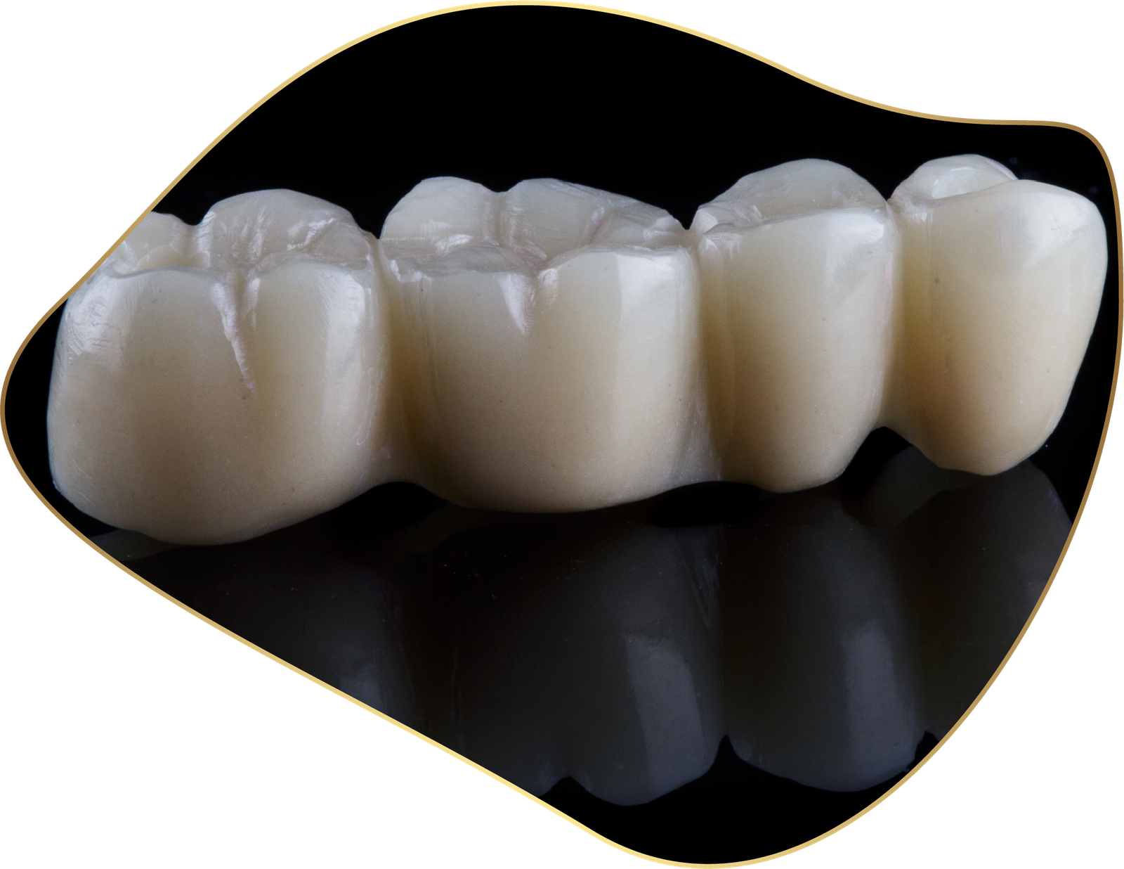 Description of Image